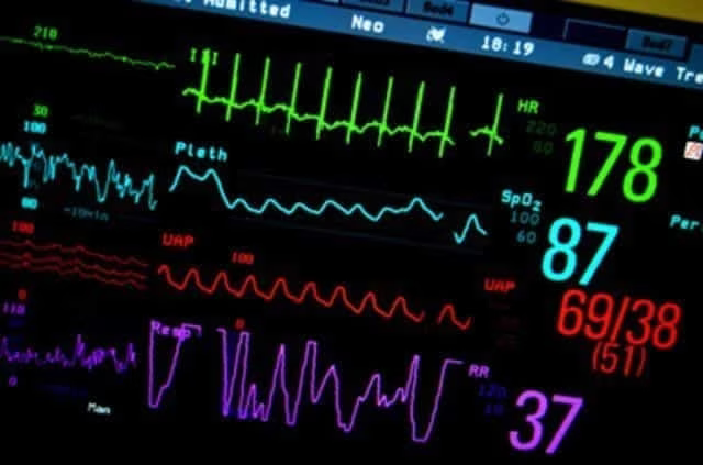 life_support_heart_and_lung_machine-e1475814785428