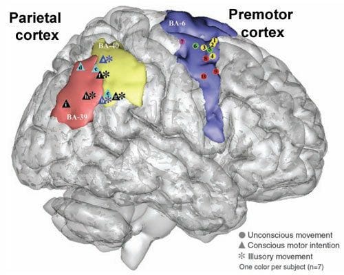 parietal