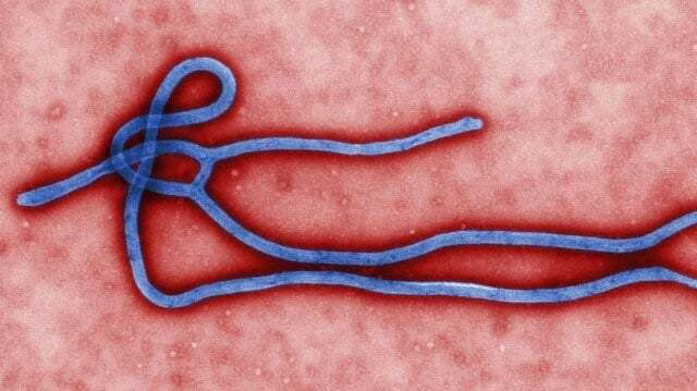 2048px-ebola_virus_virion_wide-2b02217c2e453eb36938dabf4f062492cad6de36